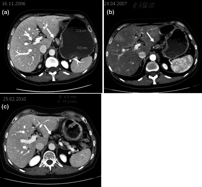 Fig. 2