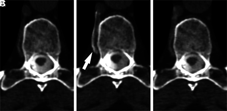 FIG 2.