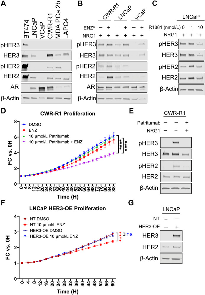 ERBB3 Overexpression is Enriched in Diverse Patient Populations with ...