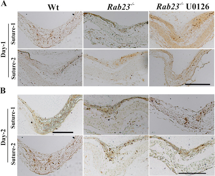 Figure 5—figure supplement 3.