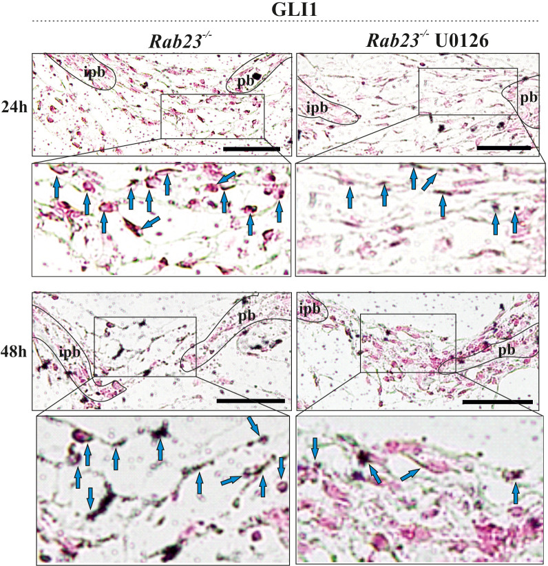 Figure 6—figure supplement 1.