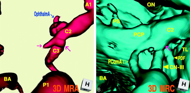 Fig 4.