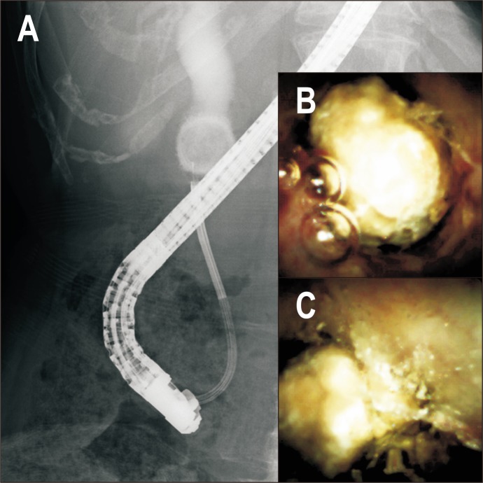 Fig. 2