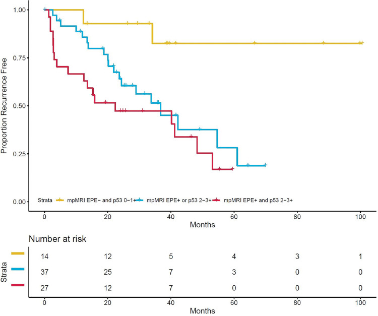 Kaplan-Meier curve of recurrence-free survival by combined multiparametric MRI-based extraprostatic extension suspicion (grades 1–3) and p53 positivity (intensity 2+ and 3+). One patient is not shown because of missing data. Censored patients are denoted by hash marks. EPE = extraprostatic extension, mpMRI = multiparametric MRI.