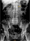 Fig. 1