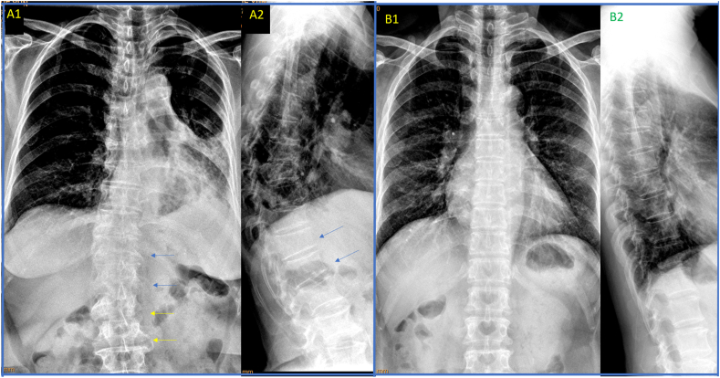 Fig. 2