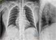 Fig. 11