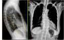 Fig. 13