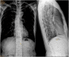 Fig. 10