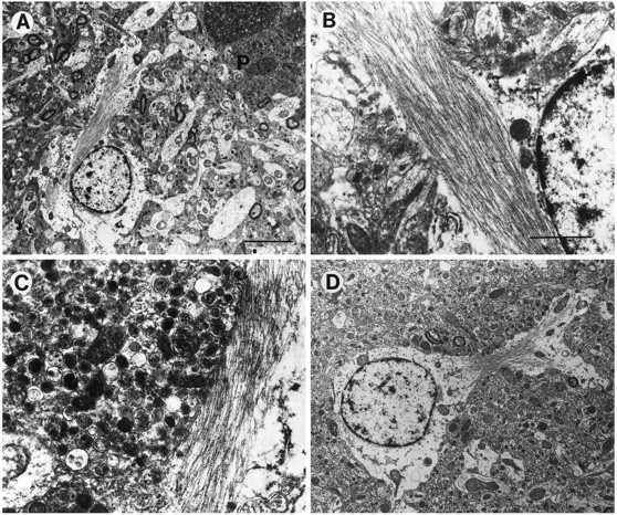 Fig. 12.