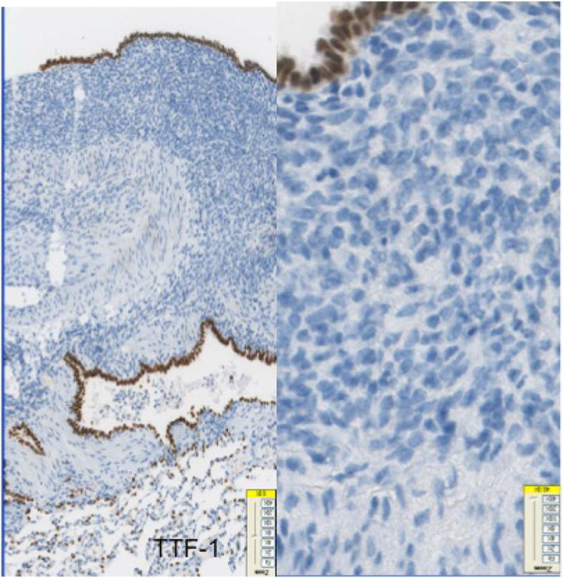 Fig-3E