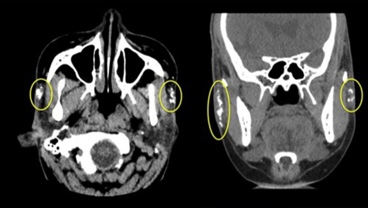 Fig 2