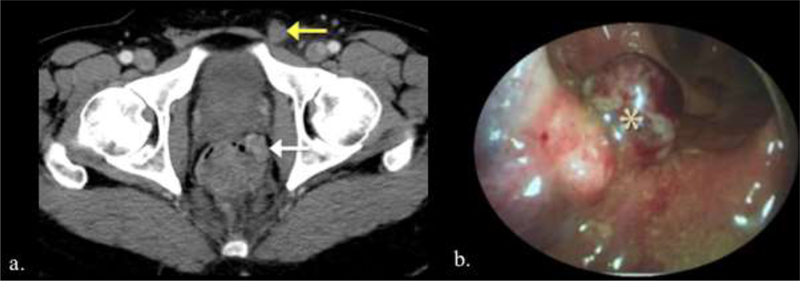 Figure 18.