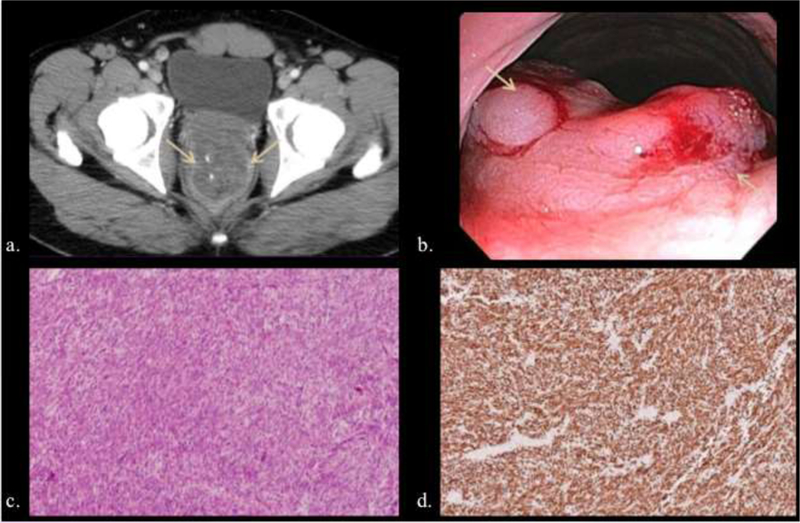 Figure 15.