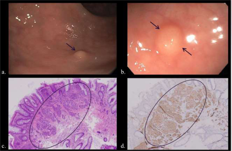 Figure 14.