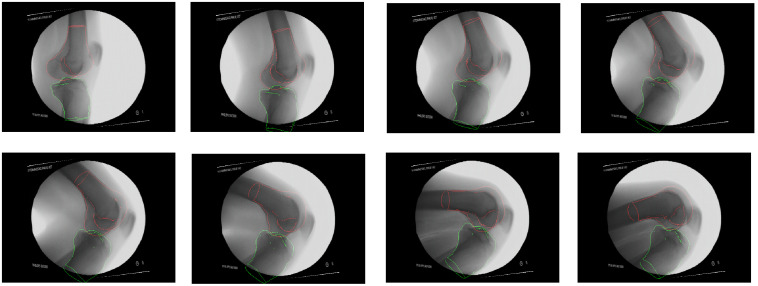 Fig. 11