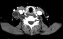 FIG. 3.3.