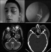 FIG. 8.3.