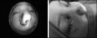 FIG. 8.6.