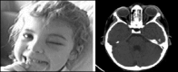 FIG. 8.2.