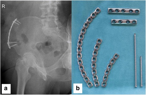 Fig. 6