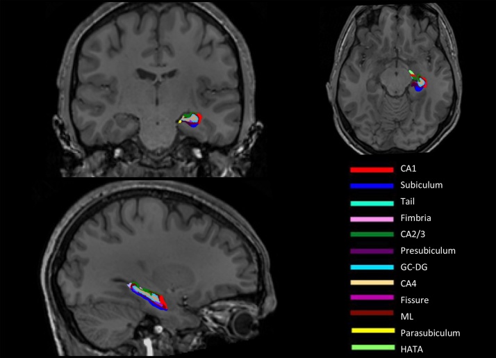 Fig. 1