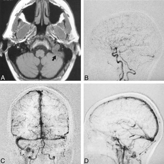 Fig 2.