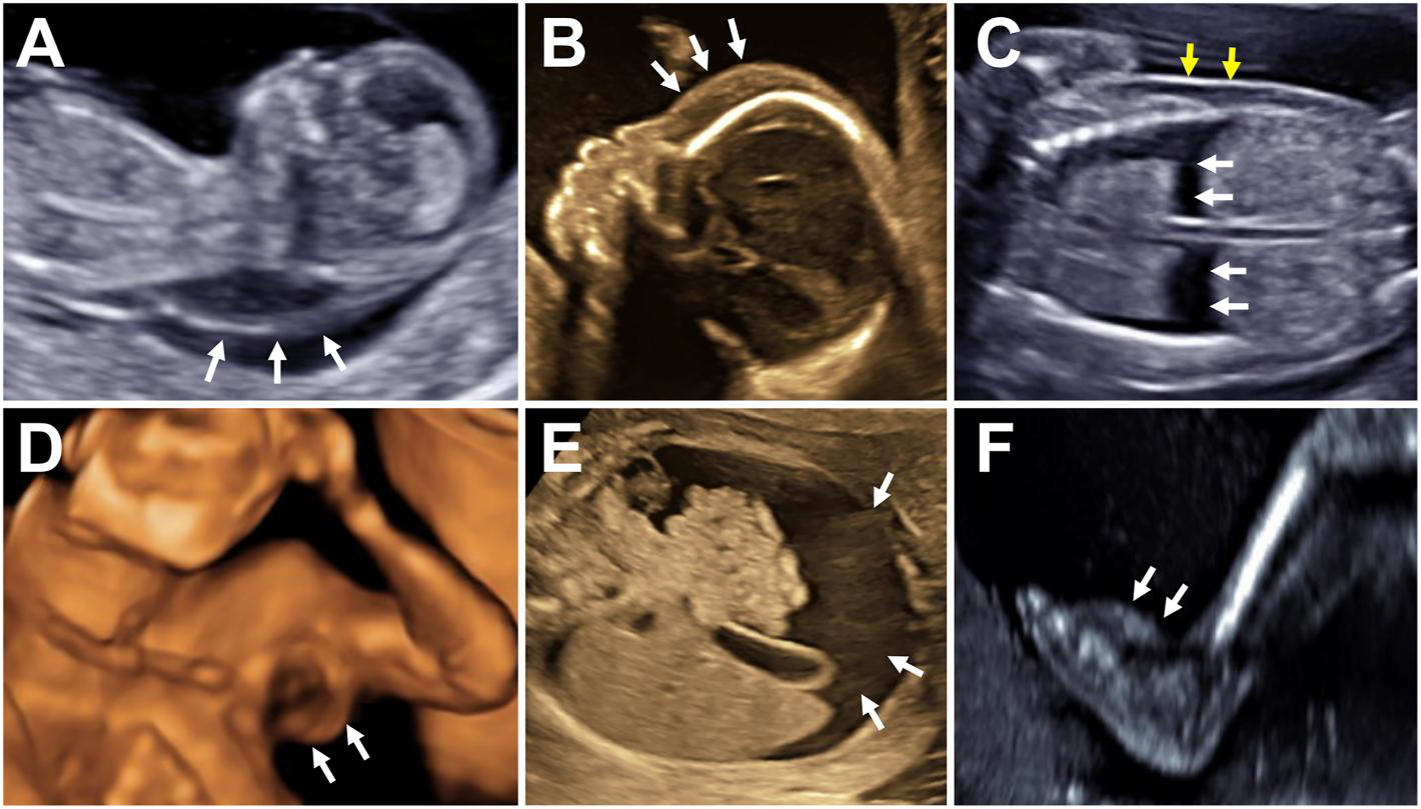 FIGURE 2