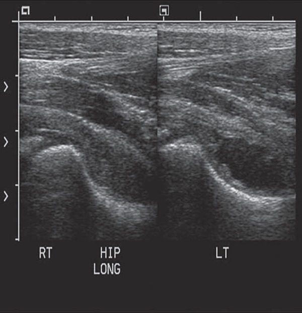 Fig. 14