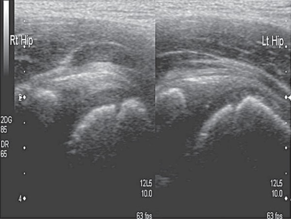 Fig. 16b