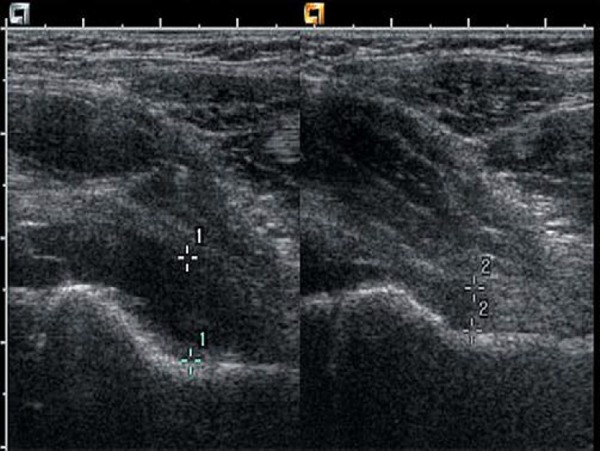 Fig. 10