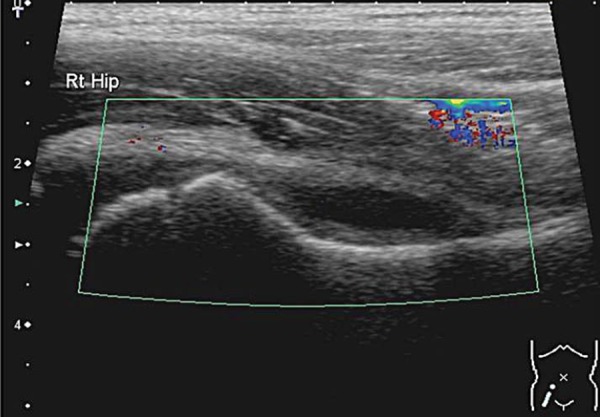 Fig. 16a