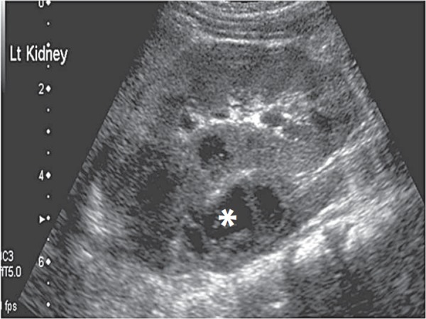 Fig. 21