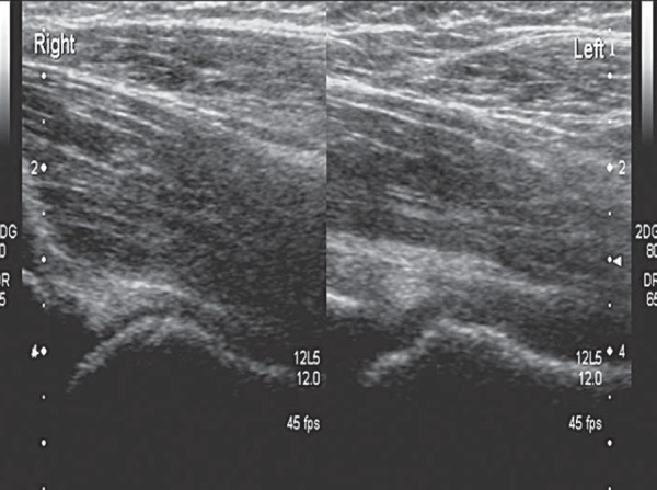 Fig. 17b