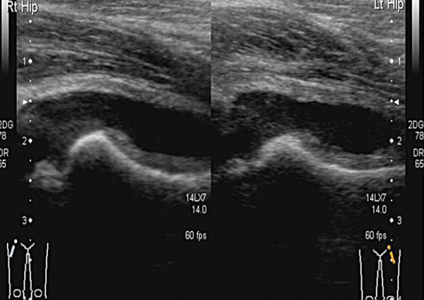 Fig. 8a