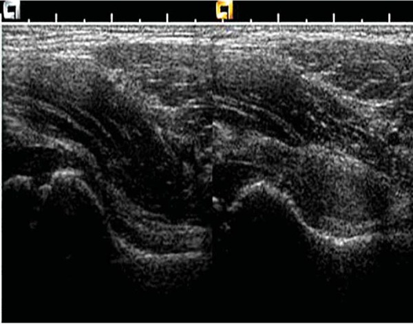 Fig. 19