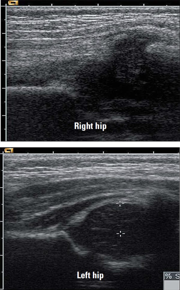 Fig. 13b