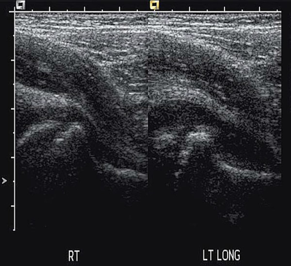 Fig. 15b