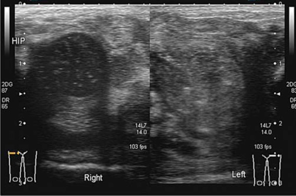 Fig. 13a