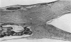 530