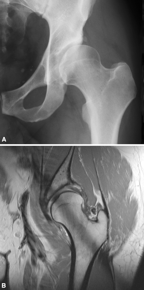 Fig. 1A–B