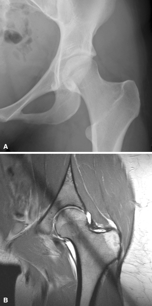 Fig. 2A–B