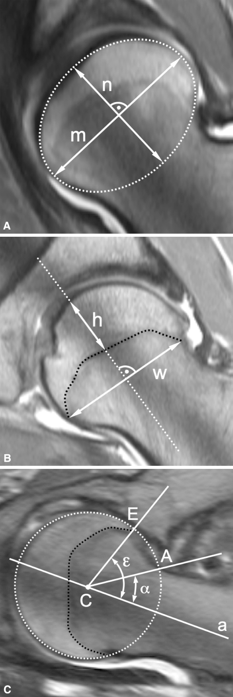 Fig. 4A–C