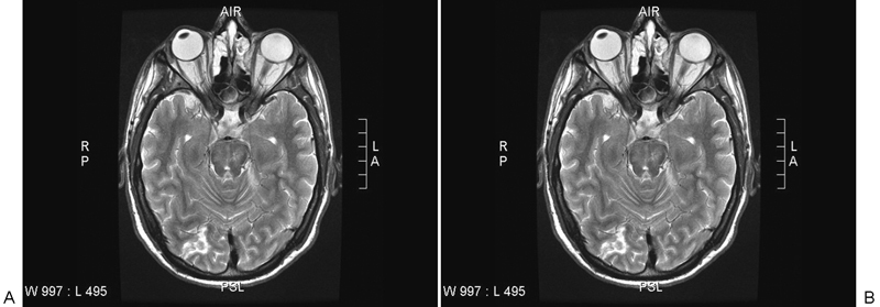 Fig. 13