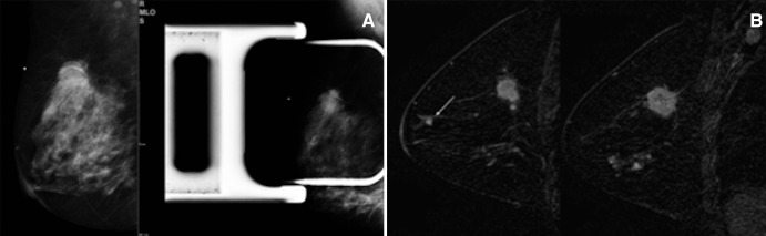 Figure 1: