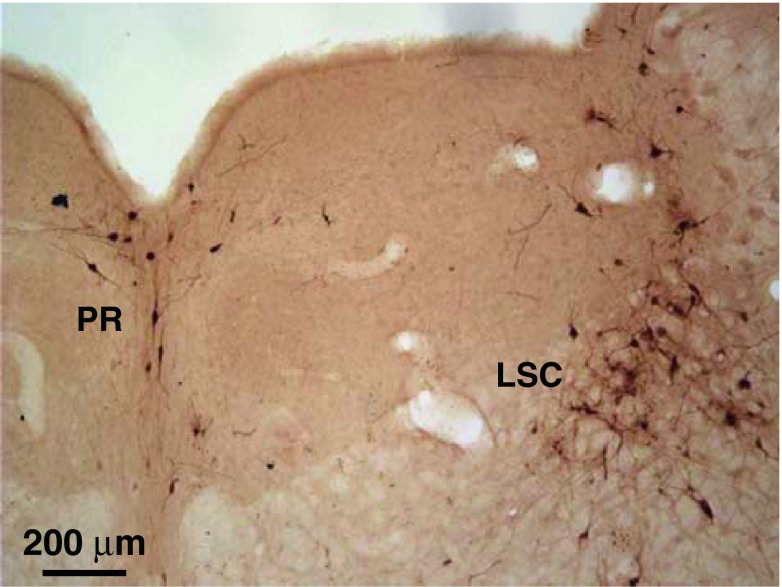 FIG. 12