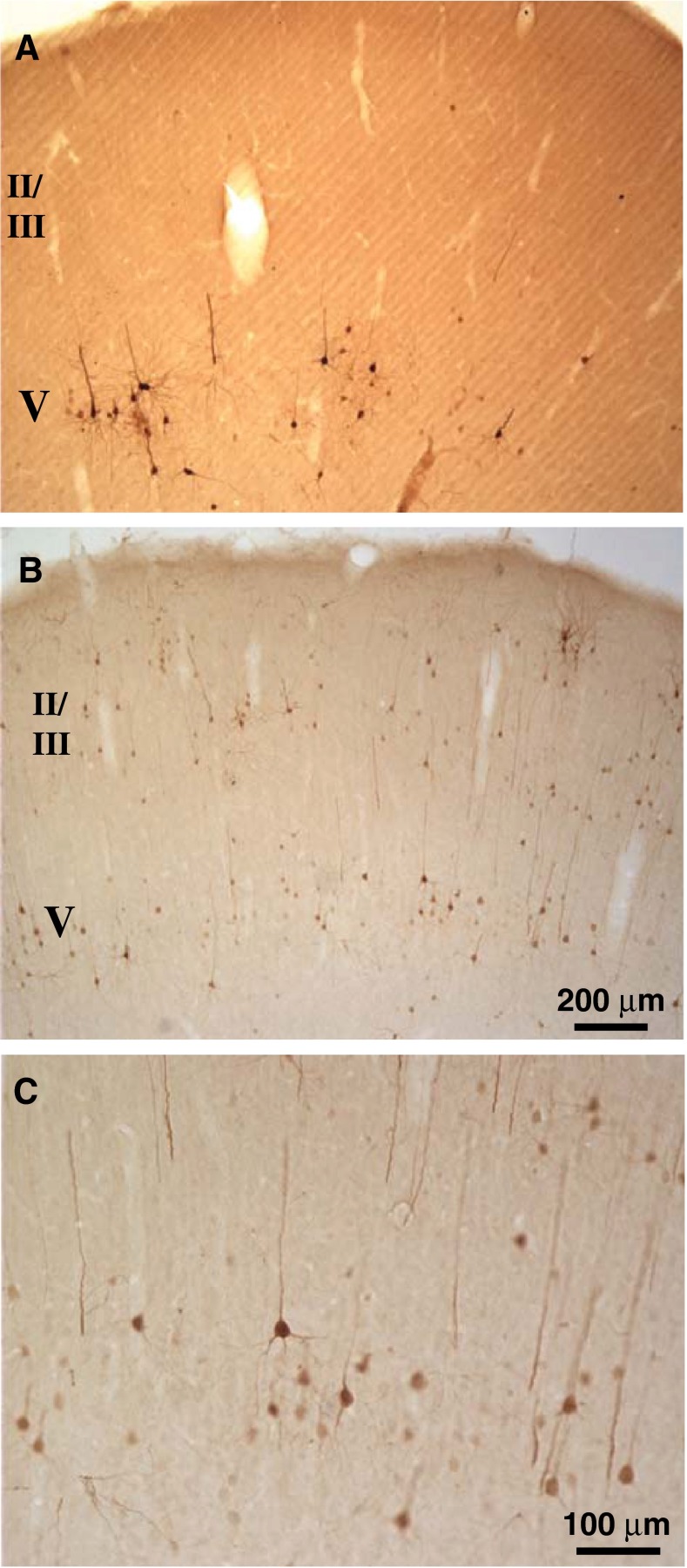 FIG. 11