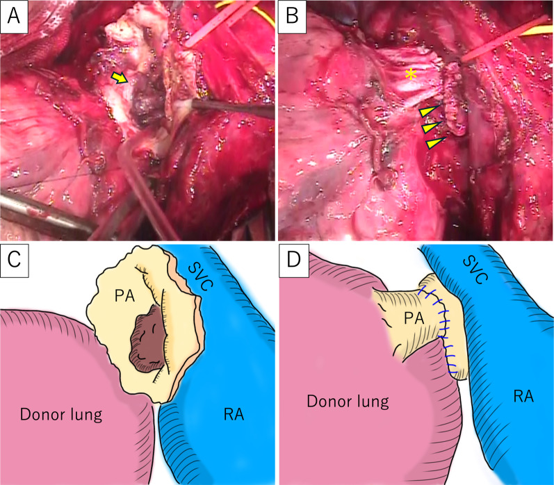 Fig. 2