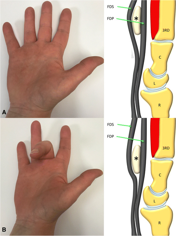 Fig. 2