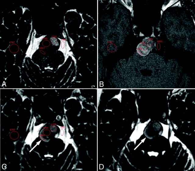 Fig 3.